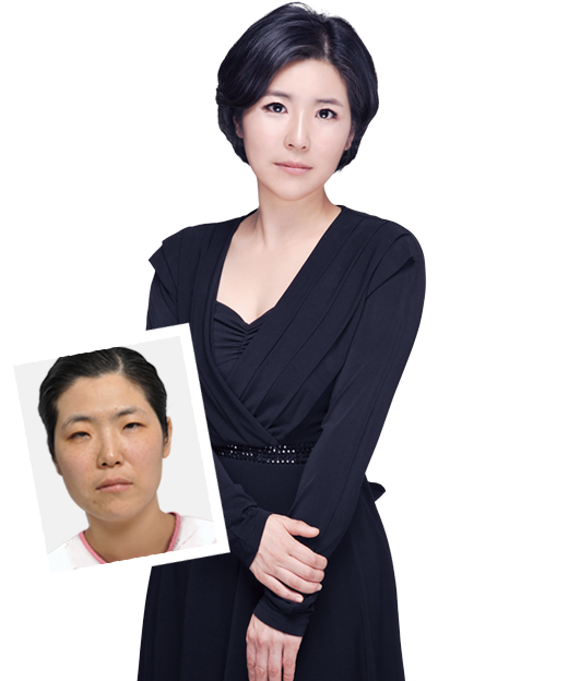 韓國灰姑娘整形外科真實(shí)整形日記
